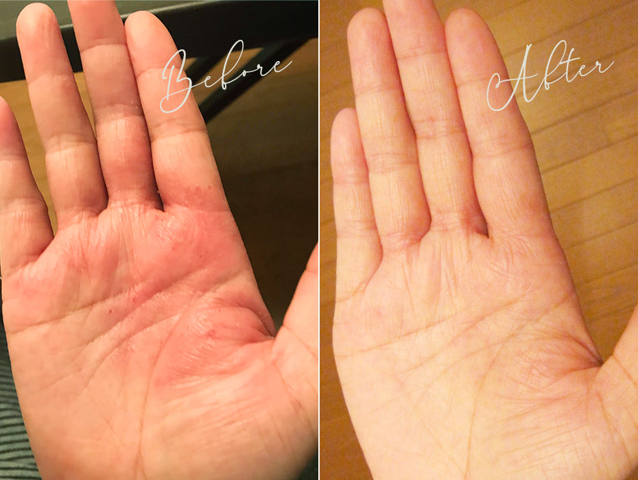 ハーバルクレンズ酵素 定期購入 720ml×2本コース – ハーバルデトックス